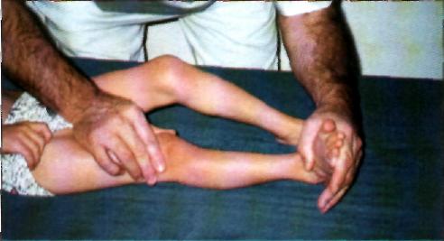 A térdkalács sípcsont irányába való
elmozdításával elérhető a lábfej mozgathatósága.